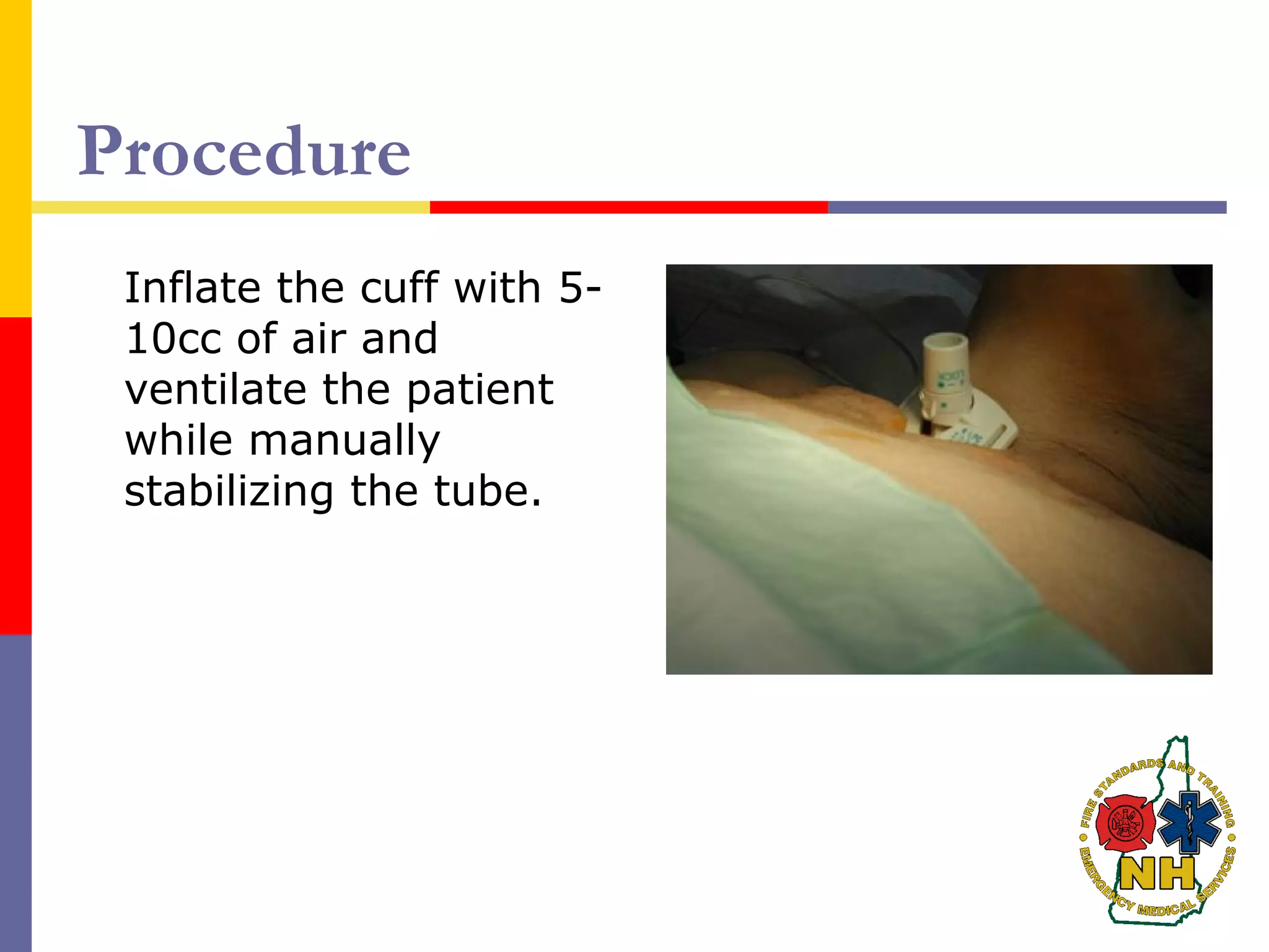 Procedure
Inflate the cuff with 5-
10cc of air and
ventilate the patient
while manually
stabilizing the tube.
 