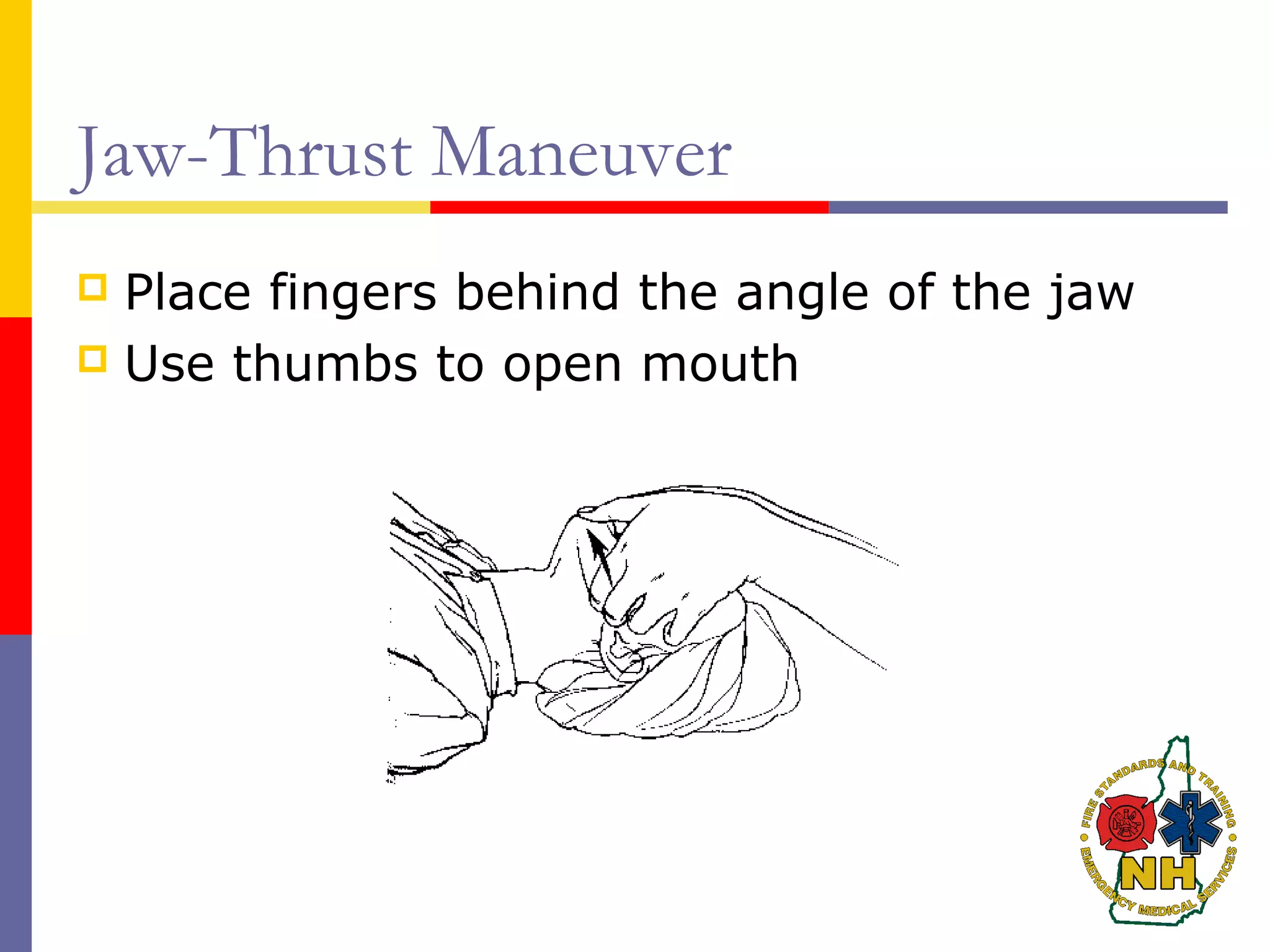 Jaw-Thrust Maneuver
 Place fingers behind the angle of the jaw
 Use thumbs to open mouth
 