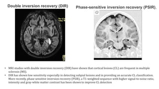 neurobehavior in functional cognitive.pptx