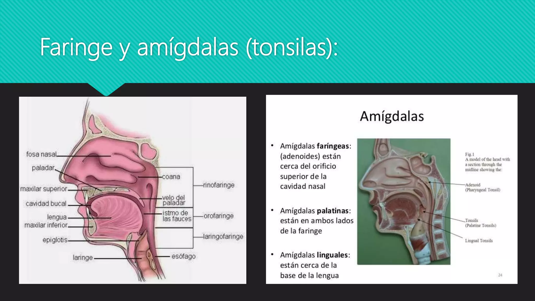 Faringitis o faringoamigdalitis | PPTX