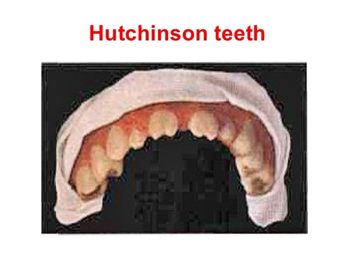 Dermatology 5th year, 5ht lecture (Dr. Ali ElEthawi)