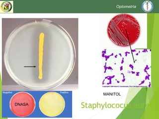 Staphylococus aureus
MANITOL
DNASA
Optometría
 