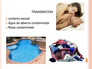 TRANSMICION
 contacto sexual
 Agua de alberca contaminada
 Ropa contaminada
 