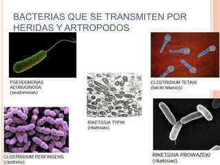 BACTERIAS QUE SE TRANSMITEN POR
HERIDAS Y ARTROPODOS
 
