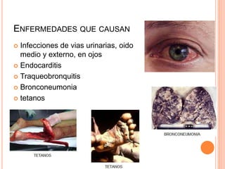 ENFERMEDADES QUE CAUSAN
 Infecciones de vias urinarias, oido
medio y externo, en ojos
 Endocarditis
 Traqueobronquitis
 Bronconeumonia
 tetanos
 