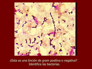 ¿Esta es una tinción de gram positiva o negativa?  Identifica las bacterias. 