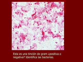 Esta es una tinción de gram ¿positiva o negativa? Identifica las bacterias. 