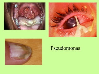 Pseudomonas 