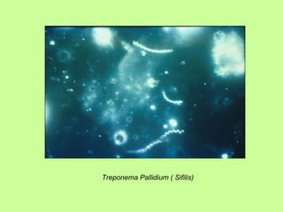 Treponema Pallidium ( Sifilis) 