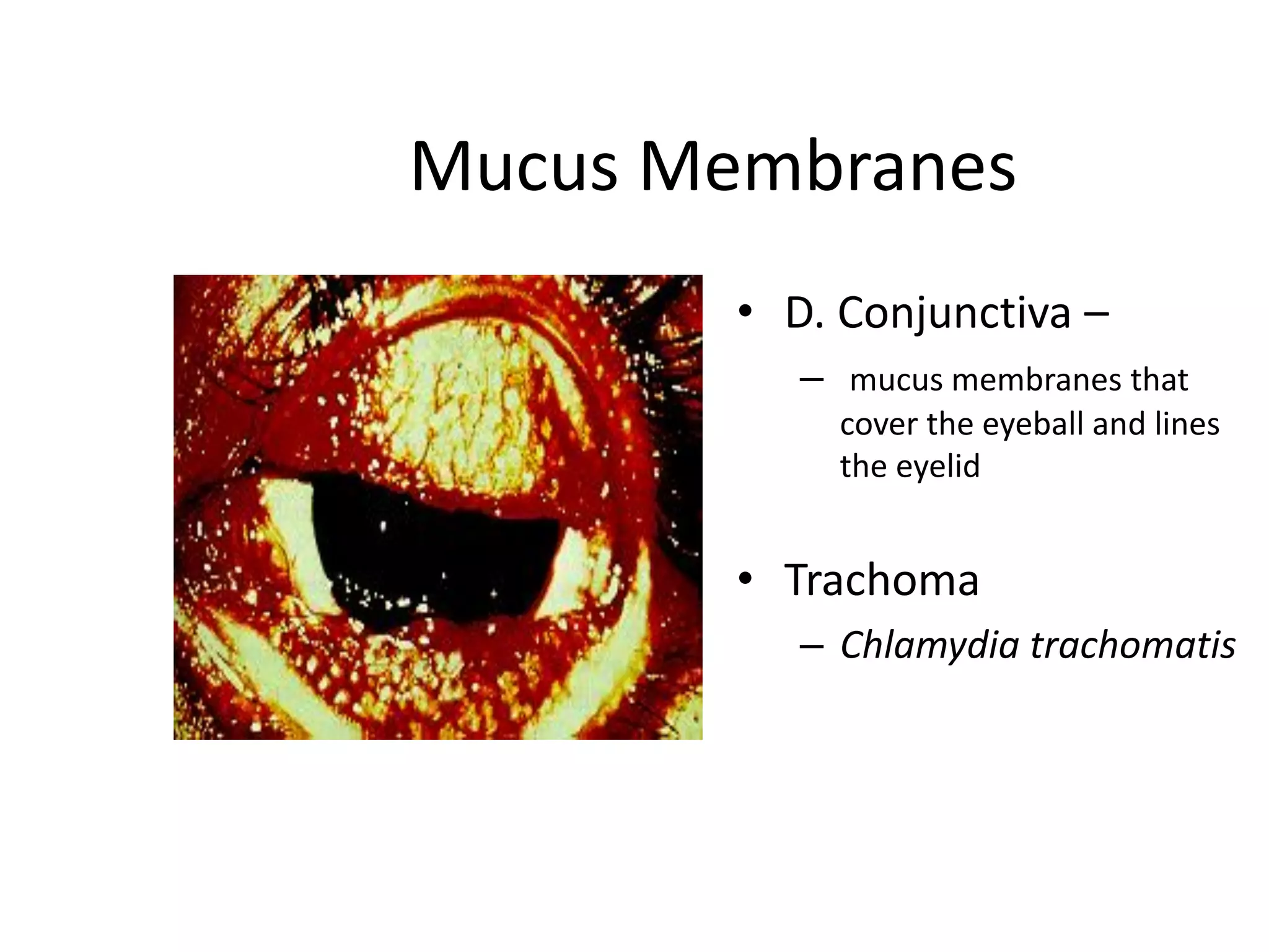 Mucus Membranes
• D. Conjunctiva –
– mucus membranes that
cover the eyeball and lines
the eyelid
• Trachoma
– Chlamydia trachomatis
 