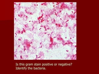 Bacteria corrosion cycle and biocorrosion.ppt