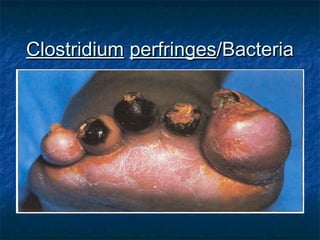 ClostridiumClostridium perfringesperfringes/Bacteria/Bacteria
 