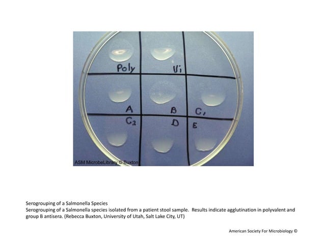 BACTERIAL-AGGLUTINATION.pptx | Chemistry | Science