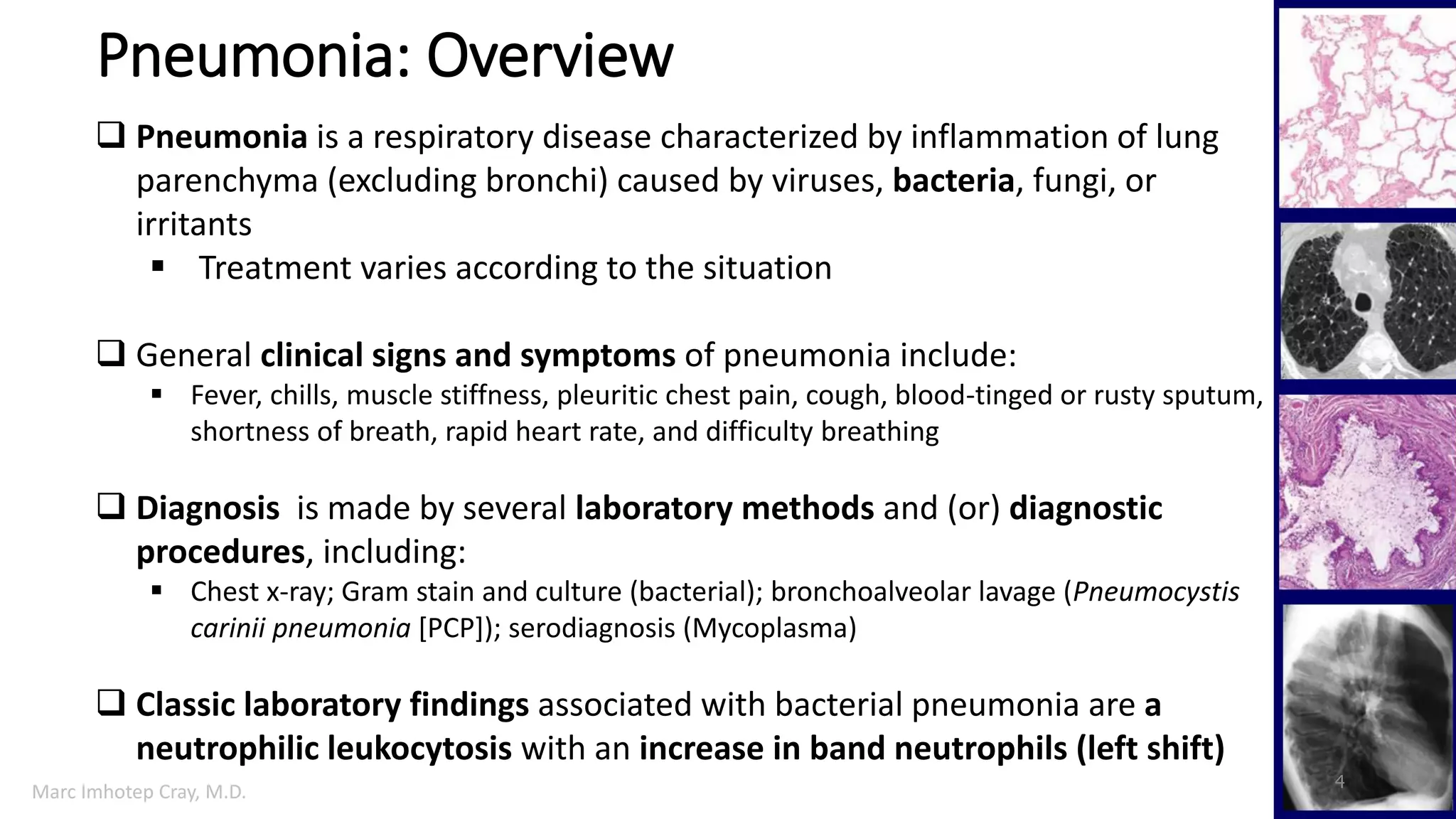 Bacterial pneumonia pharmacology | PDF