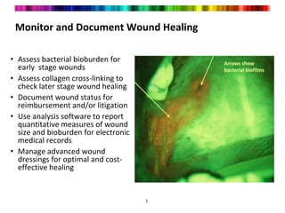 Monitor and Document Wound Healing
• Assess bacterial bioburden for
early stage wounds
• Assess collagen cross-linking to
check later stage wound healing
• Document wound status for
reimbursement and/or litigation
• Use analysis software to report
quantitative measures of wound
size and bioburden for electronic
medical records
• Manage advanced wound
dressings for optimal and cost-
effective healing
1
Arrows show
bacterial biofilms
 