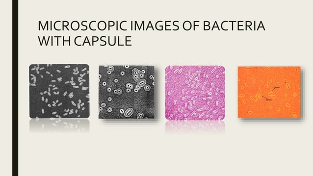 Bacterial capsule | PPT
