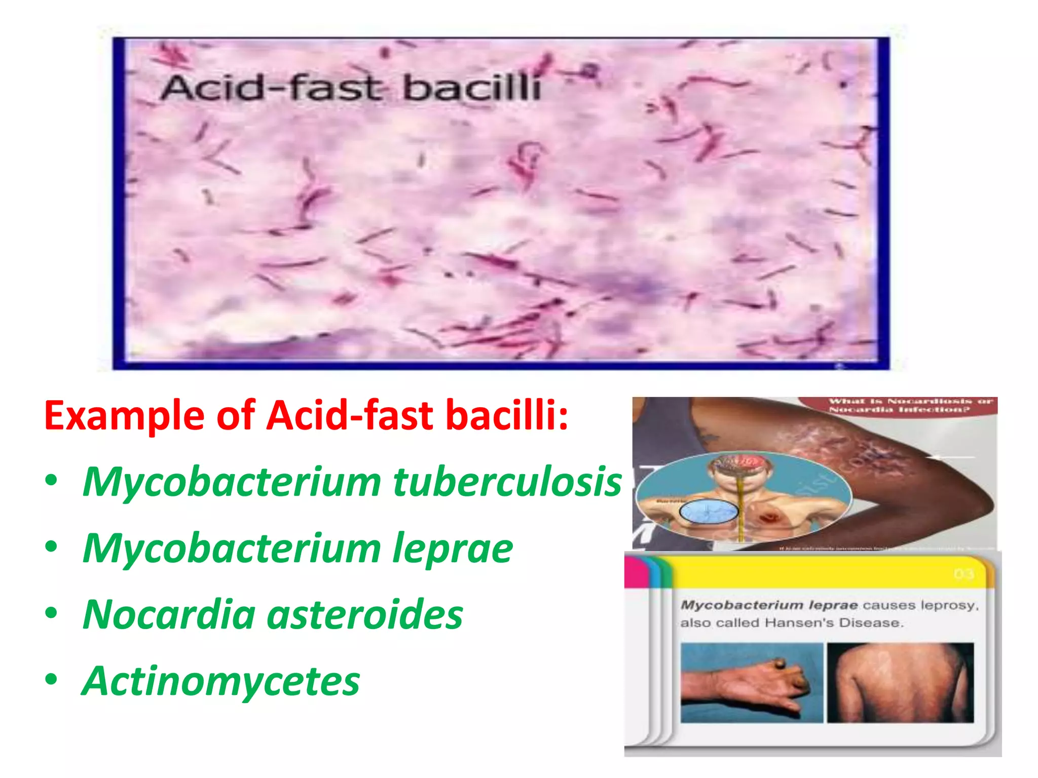 Example of Acid-fast bacilli:
• Mycobacterium tuberculosis
• Mycobacterium leprae
• Nocardia asteroides
• Actinomycetes
 
