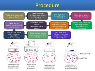 Procedure
 