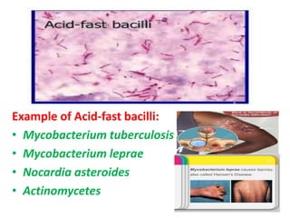 Example of Acid-fast bacilli:
• Mycobacterium tuberculosis
• Mycobacterium leprae
• Nocardia asteroides
• Actinomycetes
 