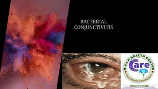Bacterial conjunctivitis