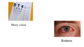 Blurry vision
Redness
 