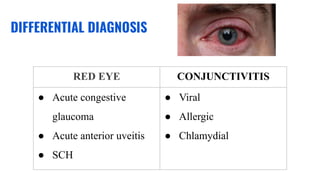 DIFFERENTIAL DIAGNOSIS
RED EYE CONJUNCTIVITIS
● Acute congestive
glaucoma
● Acute anterior uveitis
● SCH
● Viral
● Allergic
● Chlamydial
 