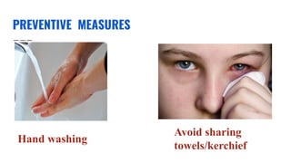 PREVENTIVE MEASURES
Hand washing
Avoid sharing
towels/kerchief
 