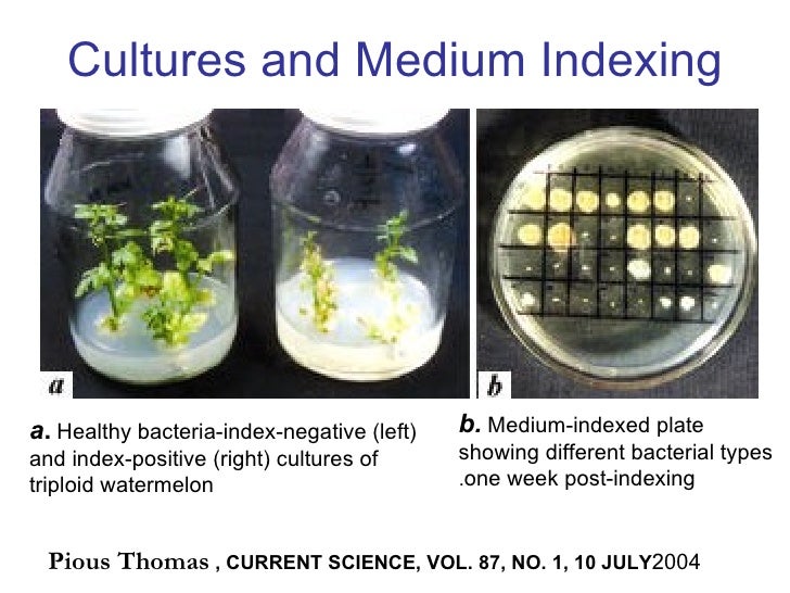 Bacterial contaminants of plant tissue culture