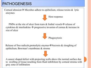PATHOGENESIS
Corneal abrasion Microbes adhere to epithelium, release toxins & lytic
enzymes
Host response
PMNs at the site of ulcer from tears & limbal vessels release of
cytokines & interleukins  progressive invasion of cornea & increase in
size of ulcer

Phagocytosis
Release of free radicals,proteolytic enymesNecrosis & sloughing of
epithelium, Bowman’s membrane & stroma

A saucer shaped defect with projecting walls above the normal surface due
to swelling of tissue resulting from fluid imbibition by corneal stroma with
grey zone of infiltration

 