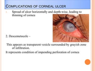 COMPLICATIONS OF CORNEAL ULCER
1.

Spread of ulcer horizontally and depth-wise, leading to
thinning of cornea

2. Descemetocele –

This appears as transparent vesicle surrounded by grayish zone
of infiltration.
It represents condition of impending perforation of cornea

 