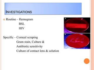 INVESTIGATIONS


Routine – Hemogram
BSL
HIV

Specific – Corneal scraping
Gram stain, Culture &
Antibiotic sensitivity
Culture of contact lens & solution

 