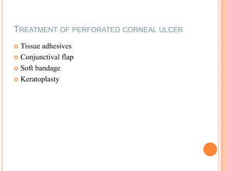 TREATMENT OF PERFORATED CORNEAL ULCER
Tissue adhesives
 Conjunctival flap
 Soft bandage
 Keratoplasty


 