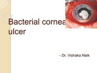 Bacterial corneal
ulcer
- Dr. Vishaka Naik
 