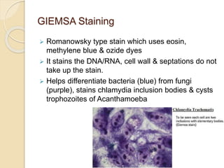 GIEMSA Staining
 Romanowsky type stain which uses eosin,
methylene blue & ozide dyes
 It stains the DNA/RNA, cell wall & septations do not
take up the stain.
 Helps differentiate bacteria (blue) from fungi
(purple), stains chlamydia inclusion bodies & cysts
trophozoites of Acanthamoeba
 
