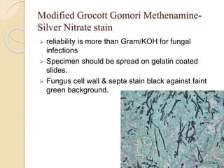 Modified Grocott Gomori Methenamine-
Silver Nitrate stain
 reliability is more than Gram/KOH for fungal
infections
 Specimen should be spread on gelatin coated
slides.
 Fungus cell wall & septa stain black against faint
green background.
 