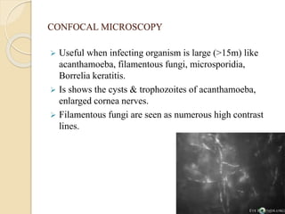 CONFOCAL MICROSCOPY
 Useful when infecting organism is large (>15m) like
acanthamoeba, filamentous fungi, microsporidia,
Borrelia keratitis.
 Is shows the cysts & trophozoites of acanthamoeba,
enlarged cornea nerves.
 Filamentous fungi are seen as numerous high contrast
lines.
 