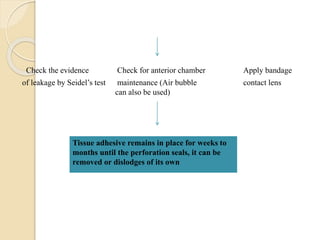 Check the evidence Check for anterior chamber Apply bandage
of leakage by Seidel’s test maintenance (Air bubble contact lens
can also be used)
Tissue adhesive remains in place for weeks to
months until the perforation seals, it can be
removed or dislodges of its own
 