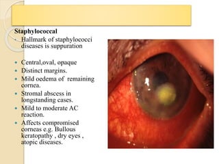 Staphylococcal
• Hallmark of staphylococci
diseases is suppuration
 Central,oval, opaque
 Distinct margins.
 Mild oedema of remaining
cornea.
 Stromal abscess in
longstanding cases.
 Mild to moderate AC
reaction.
 Affects compromised
corneas e.g. Bullous
keratopathy , dry eyes ,
atopic diseases.
 