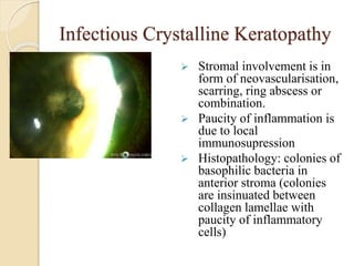 Infectious Crystalline Keratopathy
 Stromal involvement is in
form of neovascularisation,
scarring, ring abscess or
combination.
 Paucity of inflammation is
due to local
immunosupression
 Histopathology: colonies of
basophilic bacteria in
anterior stroma (colonies
are insinuated between
collagen lamellae with
paucity of inflammatory
cells)
 