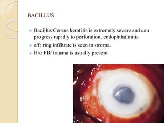BACILLUS
 Bacillus Cereus keratitis is extremely severe and can
progress rapidly to perforation, endophthalmitis.
 c/f: ring infiltrate is seen in stroma.
 H/o FB/ trauma is usually present
 