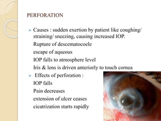 PERFORATION
 Causes : sudden exertion by patient like coughing/
straining/ sneezing, causing increased IOP.
Rupture of descematocoele
escape of aqueous
IOP falls to atmosphere level
Iris & lens is driven anteriorly to touch cornea
 Effects of perforation :
IOP falls
Pain decreases
extension of ulcer ceases
cicatrization starts rapidly
 