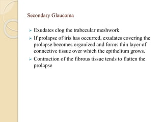 Secondary Glaucoma
 Exudates clog the trabecular meshwork
 If prolapse of iris has occurred, exudates covering the
prolapse becomes organized and forms thin layer of
connective tissue over which the epithelium grows.
 Contraction of the fibrous tissue tends to flatten the
prolapse
 