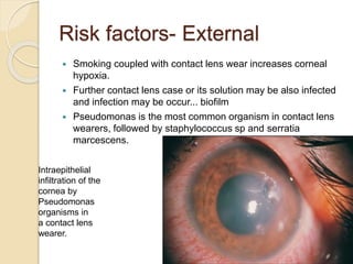 Risk factors- External
 Smoking coupled with contact lens wear increases corneal
hypoxia.
 Further contact lens case or its solution may be also infected
and infection may be occur... biofilm
 Pseudomonas is the most common organism in contact lens
wearers, followed by staphylococcus sp and serratia
marcescens.
Intraepithelial
infiltration of the
cornea by
Pseudomonas
organisms in
a contact lens
wearer.
 