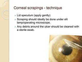 Corneal scrapings - technique
 Lid speculum (apply gently)
 Scraping should ideally be done under slit
lamp/operating microscope.
 Any debris around the ulcer should be cleaned with
a sterile swab.
 