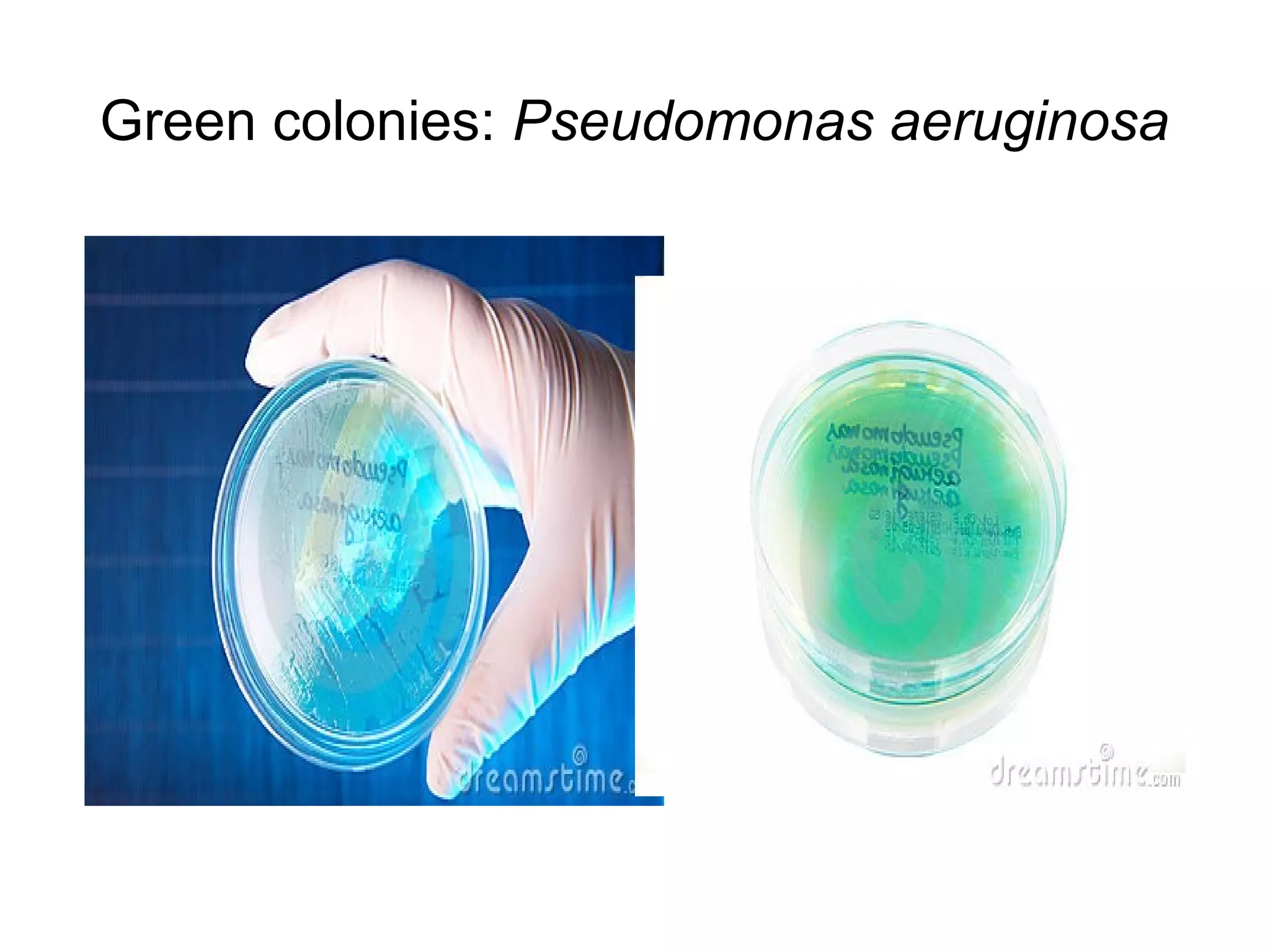 Bacterial cultures morphology based identification