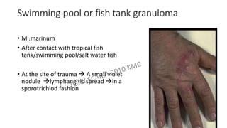 Fish Tank Rash Bacterial cutaneous infection DERMATOLOGY REVISION NOTES | PDF