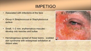 Bacterial eyelid infections and blepharitis. | PPT