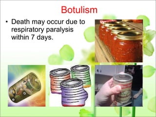 Botulism Death may occur due to respiratory paralysis within 7 days. 