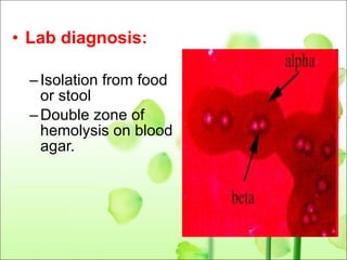 Lab diagnosis: Isolation from food or stool Double zone of hemolysis on blood agar. 