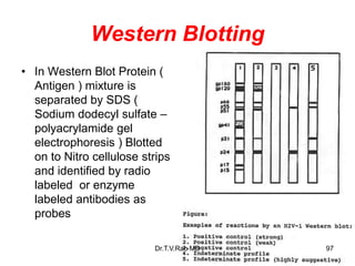 Western Blotting
• In Western Blot Protein (
Antigen ) mixture is
separated by SDS (
Sodium dodecyl sulfate –
polyacrylamide gel
electrophoresis ) Blotted
on to Nitro cellulose strips
and identified by radio
labeled or enzyme
labeled antibodies as
probes
97
Dr.T.V.Rao MD
 